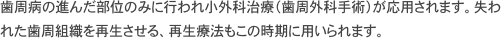 歯周病の進んだ部位のみに行われ小外科治療（歯周外科手術）が応用されます。失われた歯周組織を再生させる、再生療法もこの時期に用いられます。
