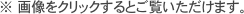 歯内療法