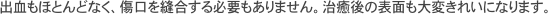 インプラント治療