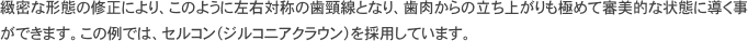 自家歯牙移植