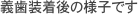 インプラント治療